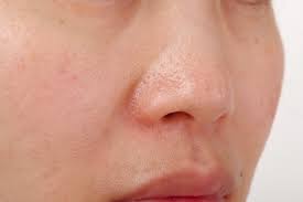 Effective-Tips-to-Minimize-Pores
