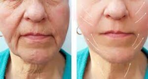Top-Anti-Aging-Skincare-Tips